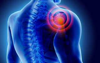 esercizi per dolore spalla